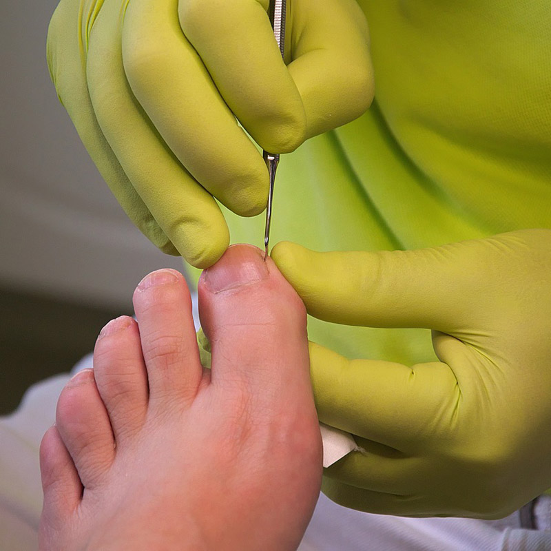 Fußpflege - für gesunde Füße